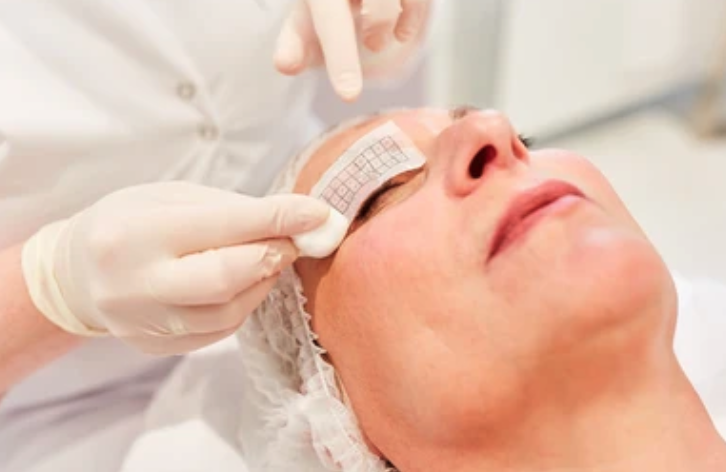 Alternative zur Oberlid-OP: Thermage oder Ultraschall-Therapie