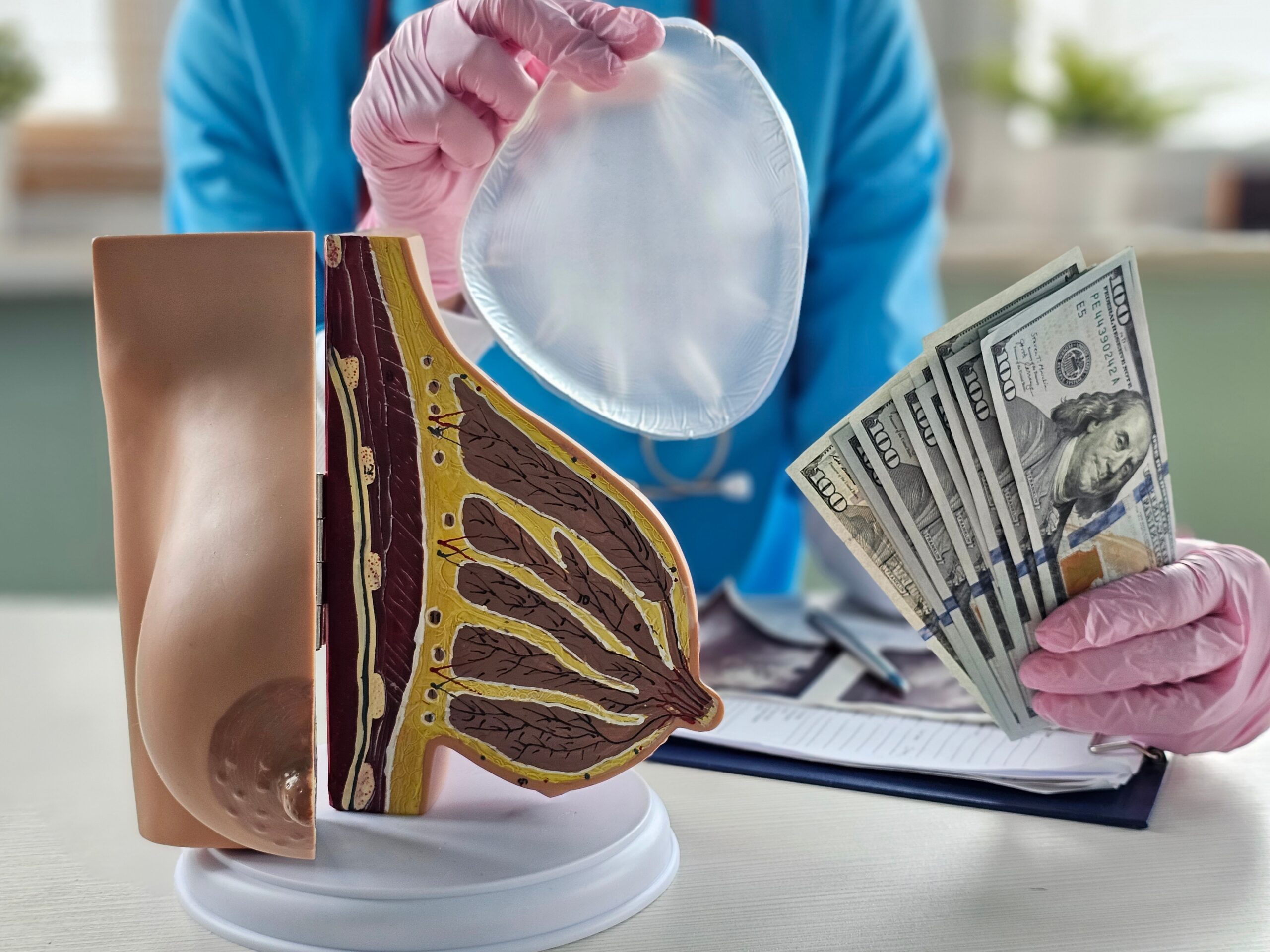 Kosten Schönheits-OP am Beispiel einer Brustvergrößerung mit Implantaten.