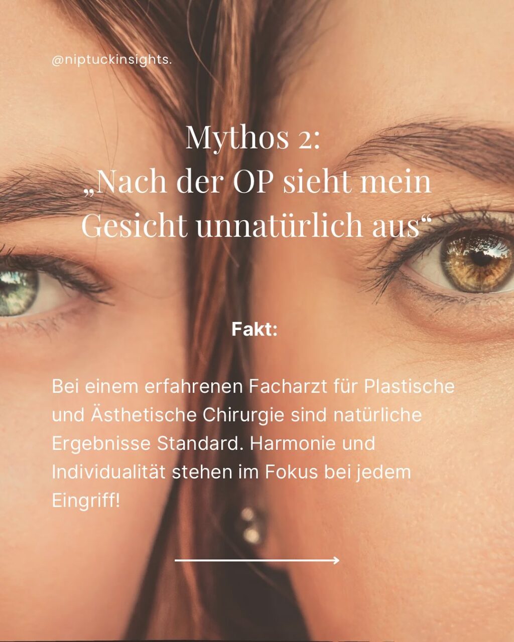 Instagram post from niptuckinsights. This post is in position 2.
